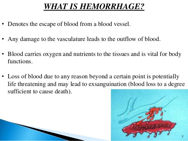 hemorrhage and its management