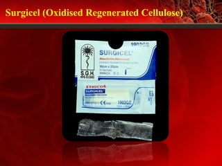 Surgicel (Oxidised Regenerated Cellulose)
 