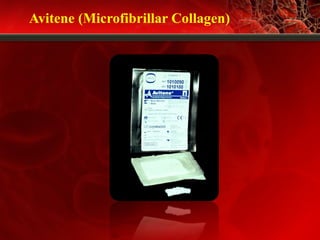 Avitene (Microfibrillar Collagen)
 