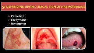 Petechiae
 Ecchymosis
 Hematoma
 