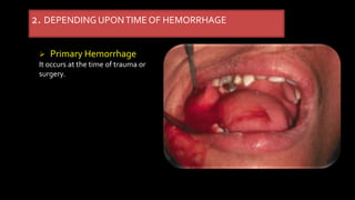 2. DEPENDINGUPONTIMEOF HEMORRHAGE
 Primary Hemorrhage
It occurs at the time of trauma or
surgery.
 