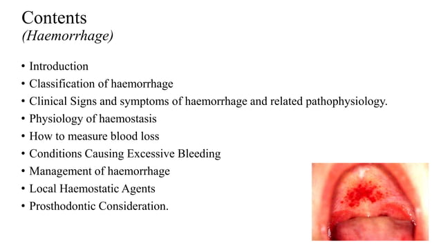 Hemorrhage and shock | PPTX | Blood Disorders | Diseases and Conditions