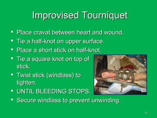 1717
Improvised TourniquetImprovised Tourniquet
 Place cravat between heart and wound.Place cravat between heart and wound.
 Tie a half-knot on upper surface.Tie a half-knot on upper surface.
 Place a short stick on half-knot.Place a short stick on half-knot.
 Tie a square knot on top ofTie a square knot on top of
stick.stick.
 Twist stick (windlass) toTwist stick (windlass) to
tighten.tighten.
 UNTIL BLEEDING STOPS.UNTIL BLEEDING STOPS.
 Secure windlass to prevent unwinding.Secure windlass to prevent unwinding.
 