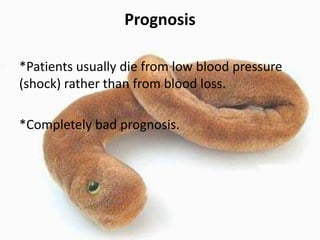 Prognosis
*Patients usually die from low blood pressure
(shock) rather than from blood loss.
*Completely bad prognosis.

 