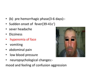• (b) pre hemorrhagic phase(3-6 days):• Sudden onset of fever(39-41c’)
• sever headache
• Dizziness
• hyperemia of face
• vomiting
• abdominal pain
• low blood pressure
• neuropsychological changes:mood and feeling of confusion aggression

 