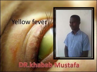 Yellow fever

 