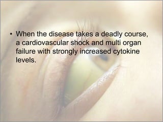 • When the disease takes a deadly course,
a cardiovascular shock and multi organ
failure with strongly increased cytokine
levels.

 