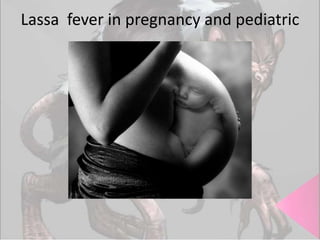 Lassa fever in pregnancy and pediatric

 