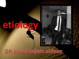etiology

 