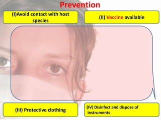 Prevention
(I)Avoid contact with host
species

(III) Protective clothing

(II) Vaccine available

(IV) Disinfect and dispose of
instruments

 