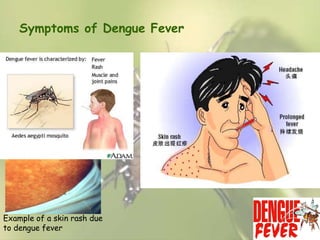 Symptoms of Dengue Fever

Example of a skin rash due
to dengue fever

 
