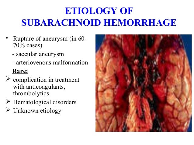 hemorrhagic stroke