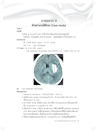 39แนวทางเวชปฏิบัติโรคหลอดเลือดสมองแตก สำหรับแพทย์
ภาคผนวก 8
ตัวอย่างกรณีศึกษา (Case study)
Case 1
ประวัติ
ชายไทย คู่ อายุ 41 ปี จ.เลย อาชีพ ค้าขาย ดื่มสุราเป็นประจำและสูบบุหรี่
- ญาติพบว่า นอนหมดสติ แขนขาขวาอ่อนแรง พูดคุยไม่รู้เรื่อง 8 ชั่วโมงก่อนมา ร.พ.
ตรวจร่างกาย
- BP 170/90 BS 87 mg/dl PT, PTT normal
- GCS = 10 , right hemiplegia
CT brain ( at 8 hrs after onset )
: - left putaminal hemorrhage , ขนาด 3*4.3*2.1 cm., midline shift 3.3 mm.
Dx Left putaminal hemorrhage
Management
1. Volume of hematoma = 3*4.3*2.1*0.524 = 14.19 cc.
2. ดูหัวข้อ basal ganglia hemorrhage ใน CPG มี criteria เพียง 1 ข้อ ( GCS = 10 )
จึงให้ medical Rx ก่อน
3. BP 170/90 mmHg ยังไม่เข้า criteria ในการให้ยา anti-hypertensive ให้ยาและสารน้ำ
เป็น conservative & supportive Rx ก่อน
4. เนื่องจากทำ CT brain ภายใน 8 ชม. หลัง onset จึงมีความเสี่ยงที่มี expanding hematoma
15 % จึงควร observe ใกล้ชิด (ดูภาคผนวก 7) ต้องประเมินเวลาที่ใช้ในการเดินทางเพื่อ refer
ไปหาประสาทศัลยแพทย์ เพื่อเป็นแนวทางในการปฏิบัติของแต่ละเครือข่าย
5. ให้อธิบายแก่ผู้ป่วยและญาติ เรื่อง Dx, management, risk ตามข้อมูลที่มีอยู่ให้เข้าใจ
 