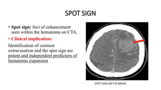 SPOT SIGN
• Spot sign: foci of enhancement
seen within the hematoma on CTA.
• Clinical implication:
Identification of contrast
extravasation and the spot sign are
potent and independent predictors of
hematoma expansion
SPOT SIGN ON CTA BRAIN
 