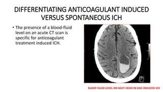 DIFFERENTIATING ANTICOAGULANT INDUCED
VERSUS SPONTANEOUS ICH
• The presence of a blood-fluid
level on an acute CT scan is
specific for anticoagulant
treatment induced ICH.
BLOOF FLUID LEVEL ON NCCT HEAD IN OAC INDUCED ICH
 