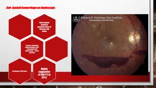 Hemorrhagic strokes ,Subarachnoid and Intrracerebral | PPTX