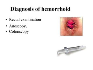 Diagnosis of hemorrhoid
• Rectal examination
• Anoscopy.
• Colonscopy
 
