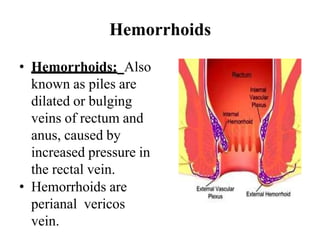 Hemorrhoids
• Hemorrhoids: Also
known as piles are
dilated or bulging
veins of rectum and
anus, caused by
increased pressure in
the rectal vein.
• Hemorrhoids are
perianal vericos
vein.
 