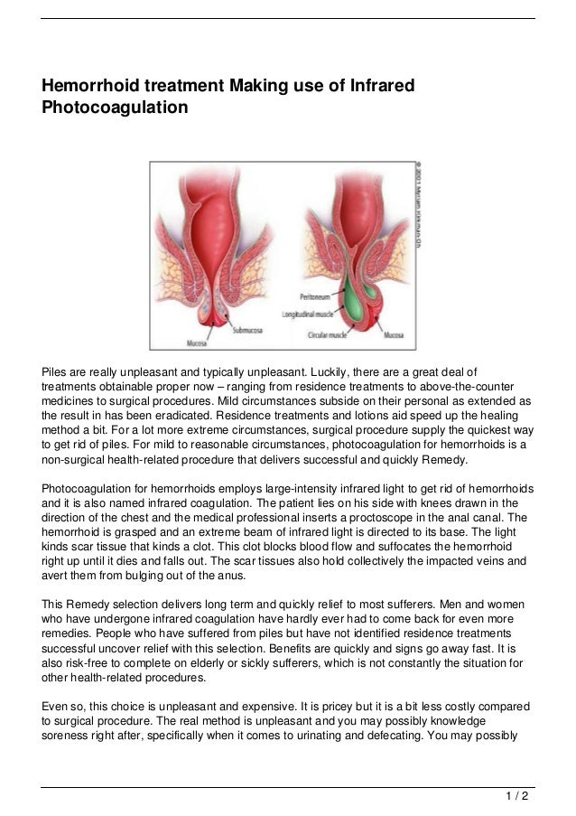 Natural Hemorrhoids Treatment Nz Natural Hemorrhoids Treatment Nz