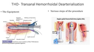 Thd Operation Hemorrhoidectomy surgical procedure RAF.pptx