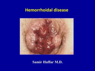 Hemorrhoidal disease
Samir Haffar M.D.
 