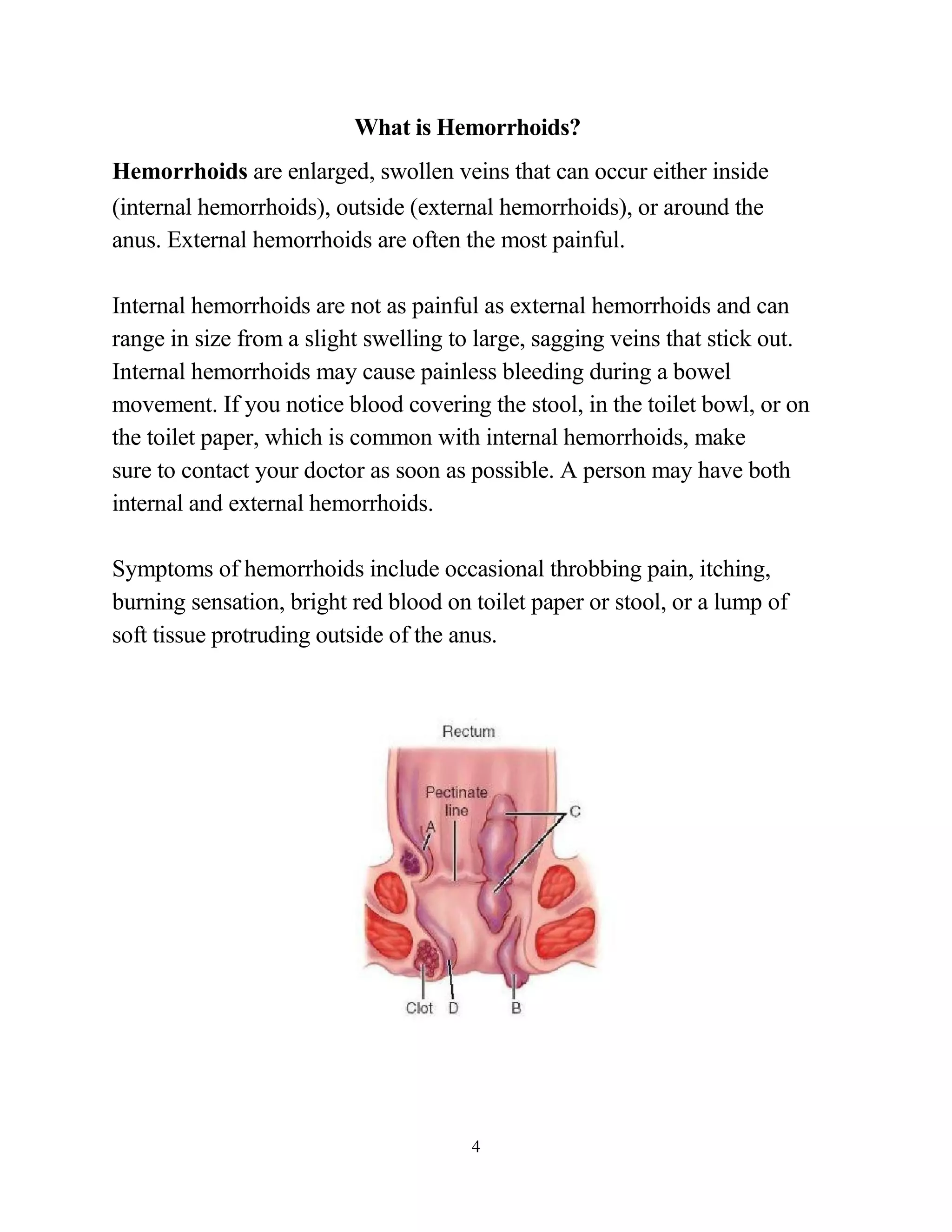 What is Hemorrhoids?
Hemorrhoids are enlarged, swollen veins that can occur either inside
(internal hemorrhoids), outside (external hemorrhoids), or around the
anus. External hemorrhoids are often the most painful.

Internal hemorrhoids are not as painful as external hemorrhoids and can
range in size from a slight swelling to large, sagging veins that stick out.
Internal hemorrhoids may cause painless bleeding during a bowel
movement. If you notice blood covering the stool, in the toilet bowl, or on
the toilet paper, which is common with internal hemorrhoids, make
sure to contact your doctor as soon as possible. A person may have both
internal and external hemorrhoids.

Symptoms of hemorrhoids include occasional throbbing pain, itching,
burning sensation, bright red blood on toilet paper or stool, or a lump of
soft tissue protruding outside of the anus.




                                       4
 
