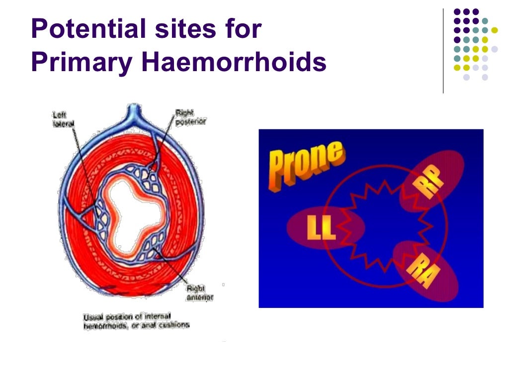 Hemorrhoids