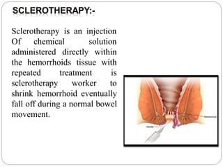 Sclerotherapy is an injection
Of chemical
administered directly
solution
within
the hemorrhoids tissue with
repeated
sclerotherapy
treatment is
worker to
shrink hemorrhoid eventually
fall off during a normal bowel
movement.
 