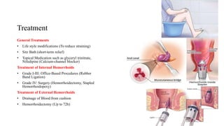 Treatment
General Treatments
• Life style modifications (To reduce straining)
• Sitz Bath (short-term relief)
• Topical Medication such as glyceryl trinitrate,
Nifedipine (Calcium-channel blocker)
Treatment of Internal Hemorrhoids
• Grade I-III: Office-Based Procedures (Rubber
Band Ligation)
• Grade IV: Surgery (Hemorrhoidectomy, Stapled
Hemorrhoidopexy)
Treatment of External Hemorrhoids
• Drainage of Blood from cushion
• Hemorrhoidectomy (Up to 72h)
 