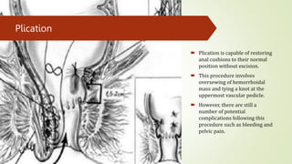 Hemorrhoids , A brief look into the topic for Medical Students | PPTX