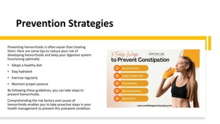 Prevention Strategies
Preventing hemorrhoids is often easier than treating
them. Here are some tips to reduce your risk of
developing hemorrhoids and keep your digestive system
functioning optimally:
• Adopt a healthy diet
• Stay hydrated
• Exercise regularly
• Maintain proper posture
By following these guidelines, you can take steps to
prevent hemorrhoids.
Comprehending the risk factors and causes of
hemorrhoids enables you to take proactive steps in your
health management to prevent this prevalent condition.
 