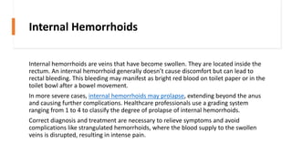 Internal Hemorrhoids
Internal hemorrhoids are veins that have become swollen. They are located inside the
rectum. An internal hemorrhoid generally doesn’t cause discomfort but can lead to
rectal bleeding. This bleeding may manifest as bright red blood on toilet paper or in the
toilet bowl after a bowel movement.
In more severe cases, internal hemorrhoids may prolapse, extending beyond the anus
and causing further complications. Healthcare professionals use a grading system
ranging from 1 to 4 to classify the degree of prolapse of internal hemorrhoids.
Correct diagnosis and treatment are necessary to relieve symptoms and avoid
complications like strangulated hemorrhoids, where the blood supply to the swollen
veins is disrupted, resulting in intense pain.
 