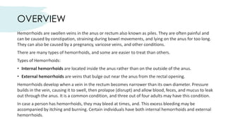 Hemorrhoids- How You Can Treat Them.pdf