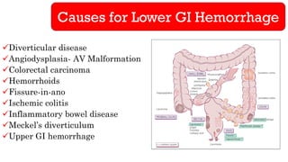 Causes for Lower GI Hemorrhage
✓Diverticular disease
✓Angiodysplasia- AV Malformation
✓Colorectal carcinoma
✓Hemorrhoids
✓Fissure-in-ano
✓Ischemic colitis
✓Inflammatory bowel disease
✓Meckel’s diverticulum
✓Upper GI hemorrhage
 