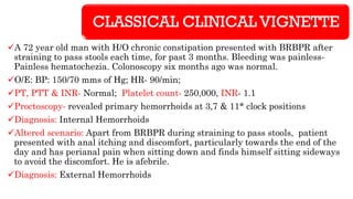 CLASSICAL CLINICAL VIGNETTE
✓A 72 year old man with H/O chronic constipation presented with BRBPR after
straining to pass stools each time, for past 3 months. Bleeding was painless-
Painless hematochezia. Colonoscopy six months ago was normal.
✓O/E: BP: 150/70 mms of Hg; HR- 90/min;
✓PT, PTT & INR- Normal; Platelet count- 250,000, INR- 1.1
✓Proctoscopy- revealed primary hemorrhoids at 3,7 & 11* clock positions
✓Diagnosis: Internal Hemorrhoids
✓Altered scenario: Apart from BRBPR during straining to pass stools, patient
presented with anal itching and discomfort, particularly towards the end of the
day and has perianal pain when sitting down and finds himself sitting sideways
to avoid the discomfort. He is afebrile.
✓Diagnosis: External Hemorrhoids
 