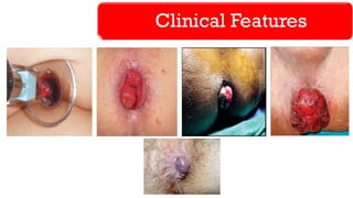 Clinical Features
 
