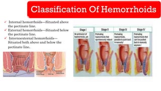 hemorrhoids-lowergihemorrhage-170326044209 (1).pdf