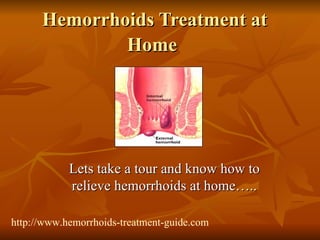 Hemorrhoids Treatment at Home   Lets take a tour and know how to relieve hemorrhoids at home….. http://www.hemorrhoids-treatment-guide.com 