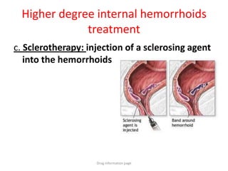 Higher degree internal hemorrhoids
treatment
c. Sclerotherapy: injection of a sclerosing agent
into the hemorrhoids
Drug information page
 