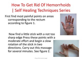 How To Get Rid Of Hemorrhoids
| Self Healing Techniques Series
First find most painful points on areas
corresponding to the rectum
according to figure 1.
Now find a little stick with a not too
sharp edge Press these points with a
moderate effort and begin a slow
rotation of the stick in two
directions. Carry out this massage
for several minutes. See figure 2.
Drug information page
 
