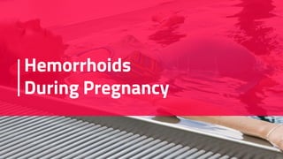 Hemorrhoids
During Pregnancy
 