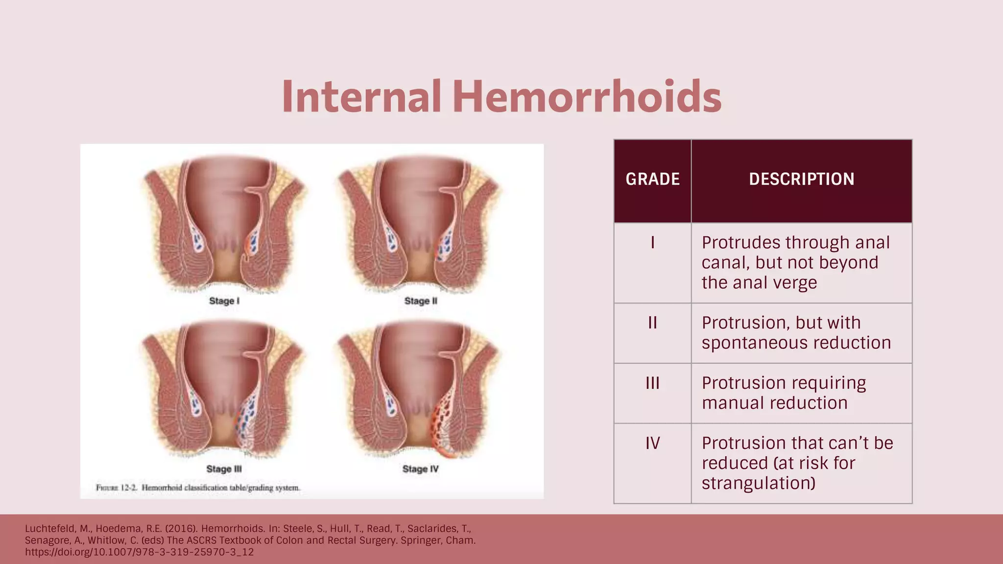 hemorrhoids_fistula.pptx