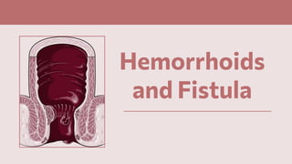 Hemorrhoids
and Fistula
 