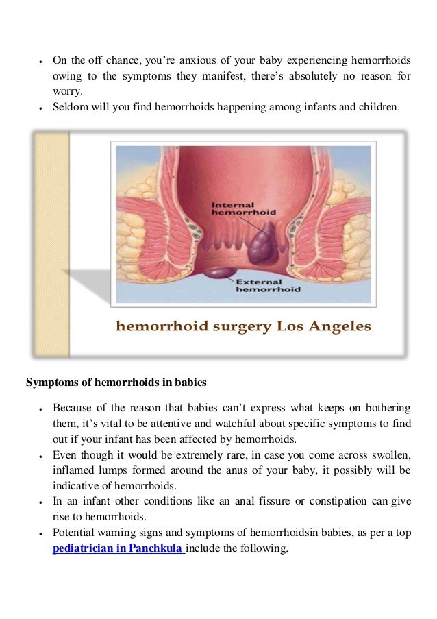 Hemorrhoids In Babies Symptoms And Causes Hemorrhoids In Babies Symptoms And Causes