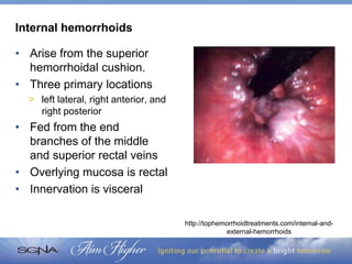 Kiss Your Hemorrhoids Goodbye: Surgical and Non-Surgical Management ...