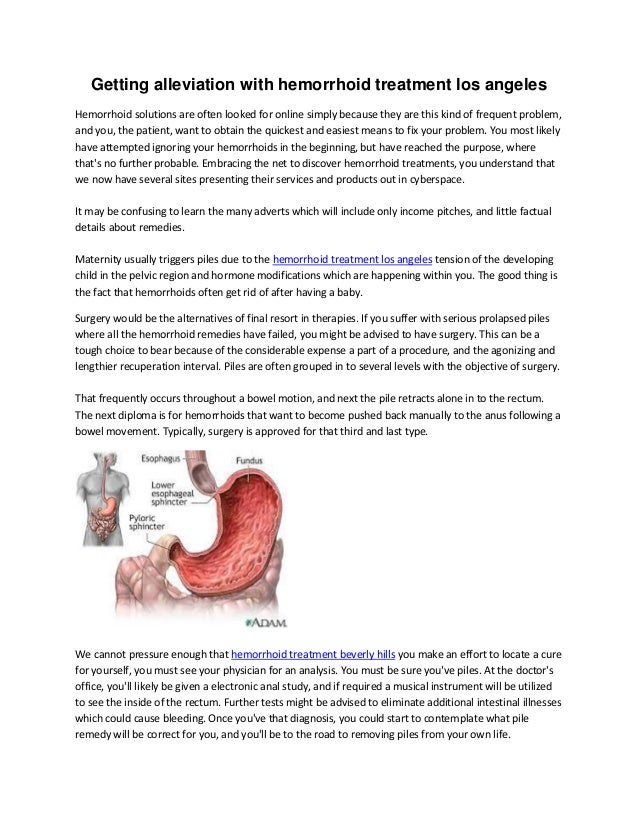 Hemorrhoid treatment los angeles