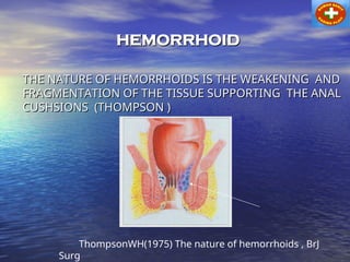 hemorrhoid tHERAPY AND MANAGEMENT to day.ppt