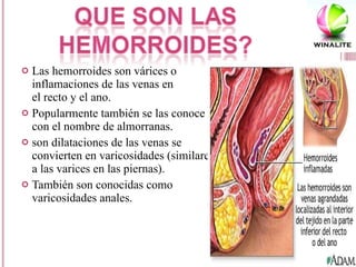 Las hemorroides son várices o inflamaciones de las venas en el recto y el ano.  Popularmente también se las conoce con el nombre de almorranas. son dilataciones de las venas se convierten en varicosidades (similares a las varices en las piernas). También son conocidas como varicosidades anales. 
