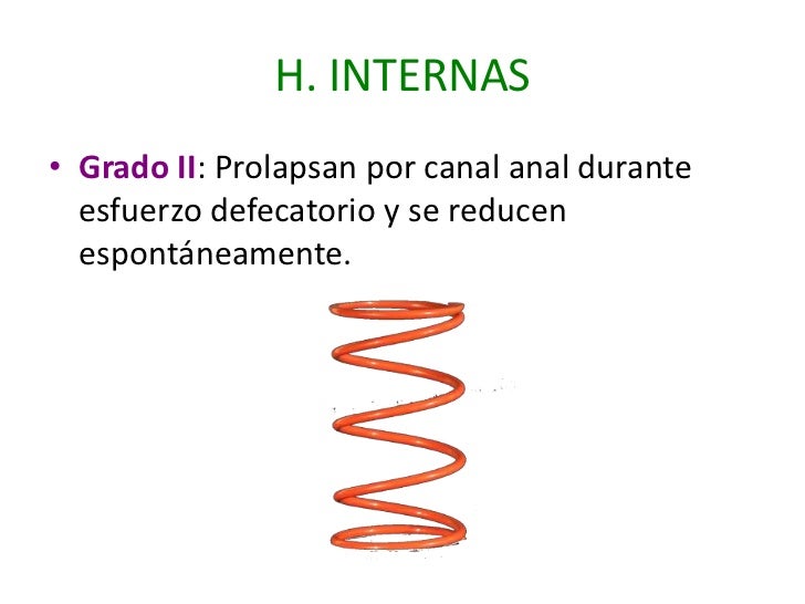 Hemorroides Hemorroides