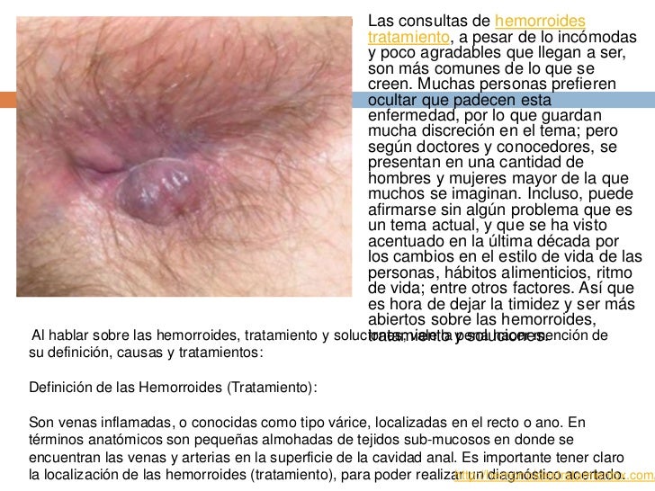 De que a las mujeres varikoz
